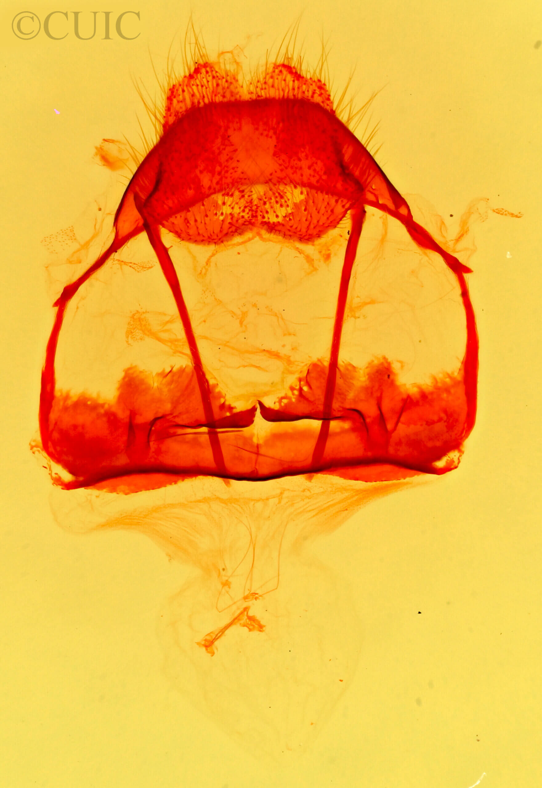 genitalia view of adult Tolype  laricis