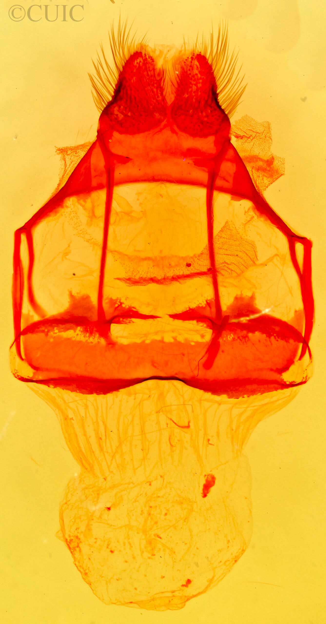 genitalia view of adult Tolype austella