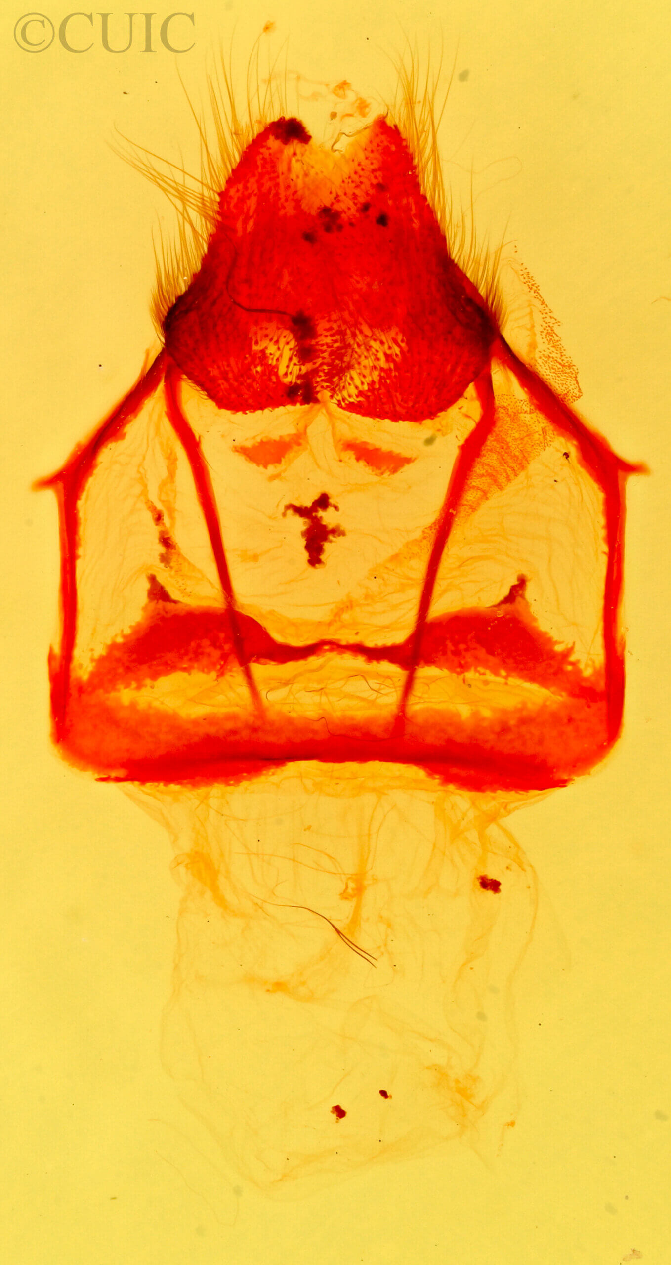 genitalia view of adult Tolype distincta