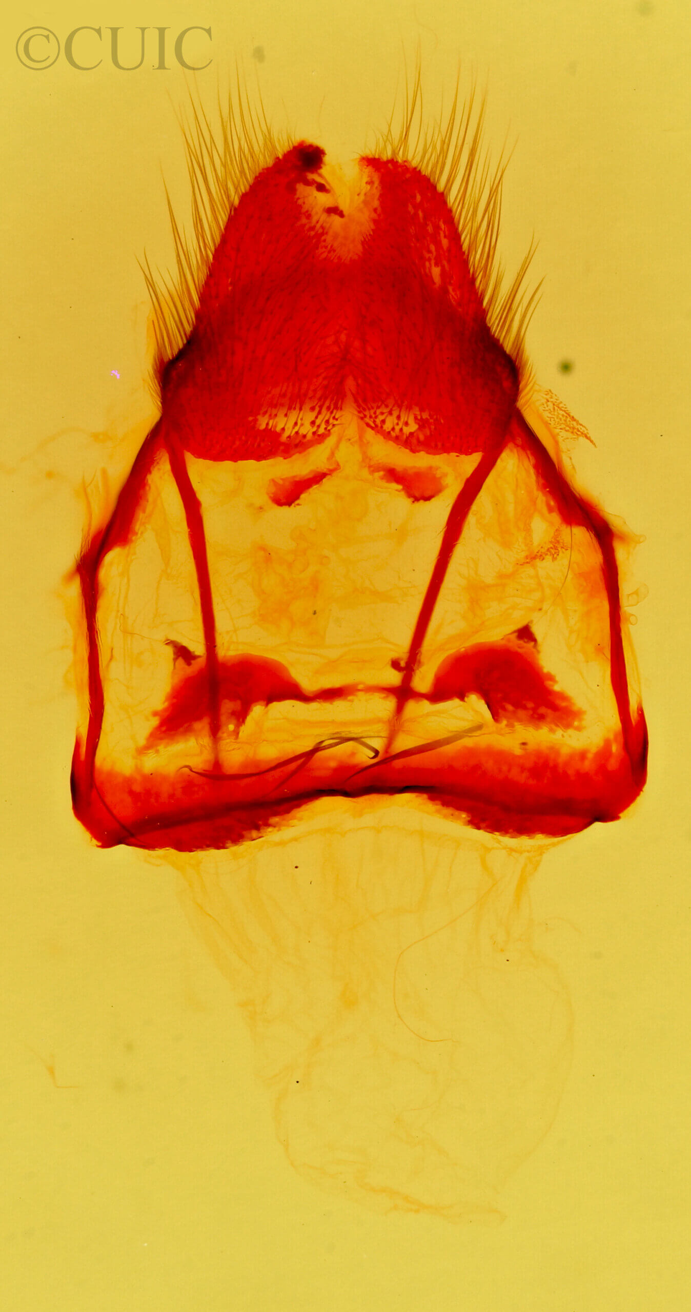 genitalia view of adult Tolype  distincta