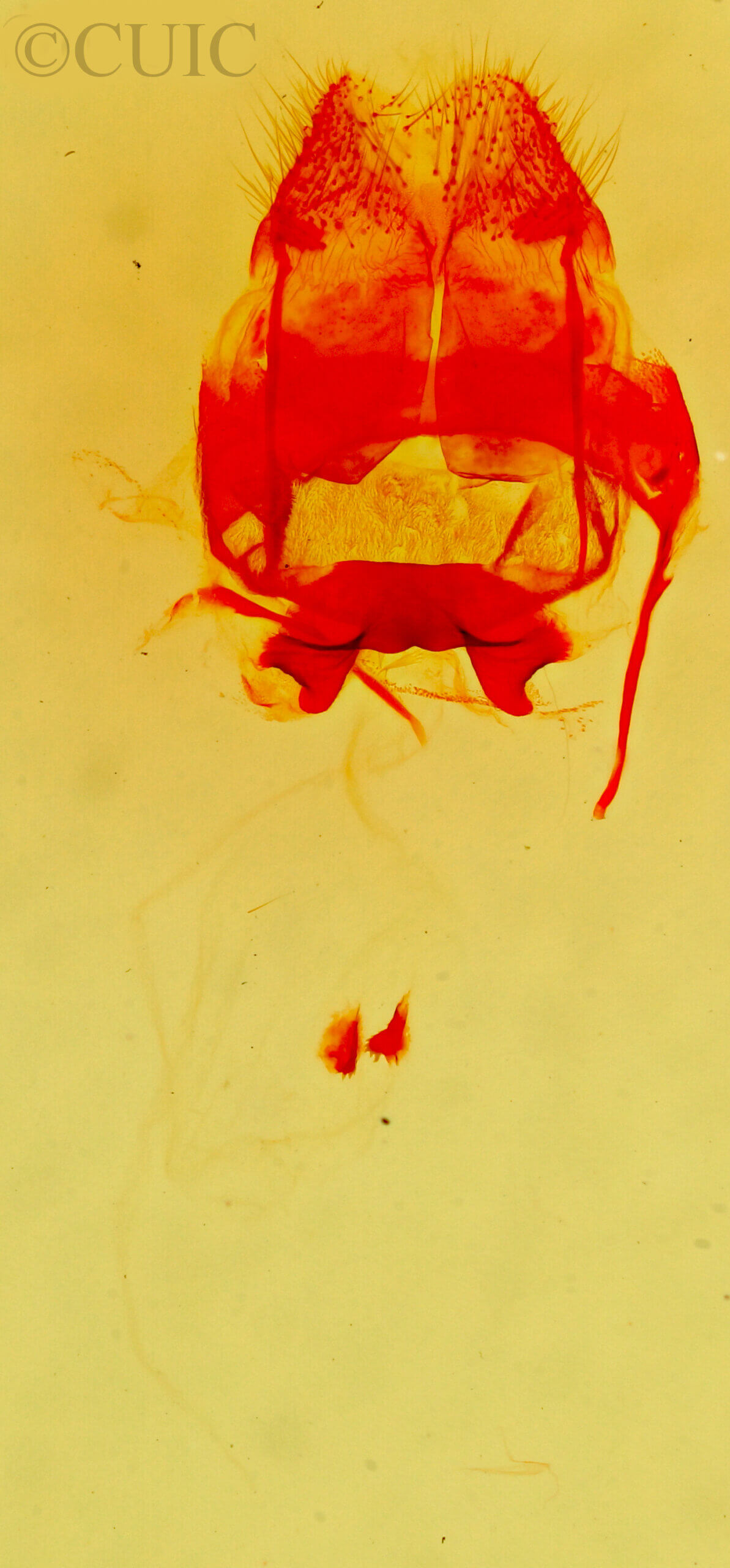 genitalia view of adult Hypopacha grisea