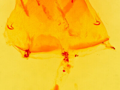 genitalia view of adult Lacosoma arizonicum