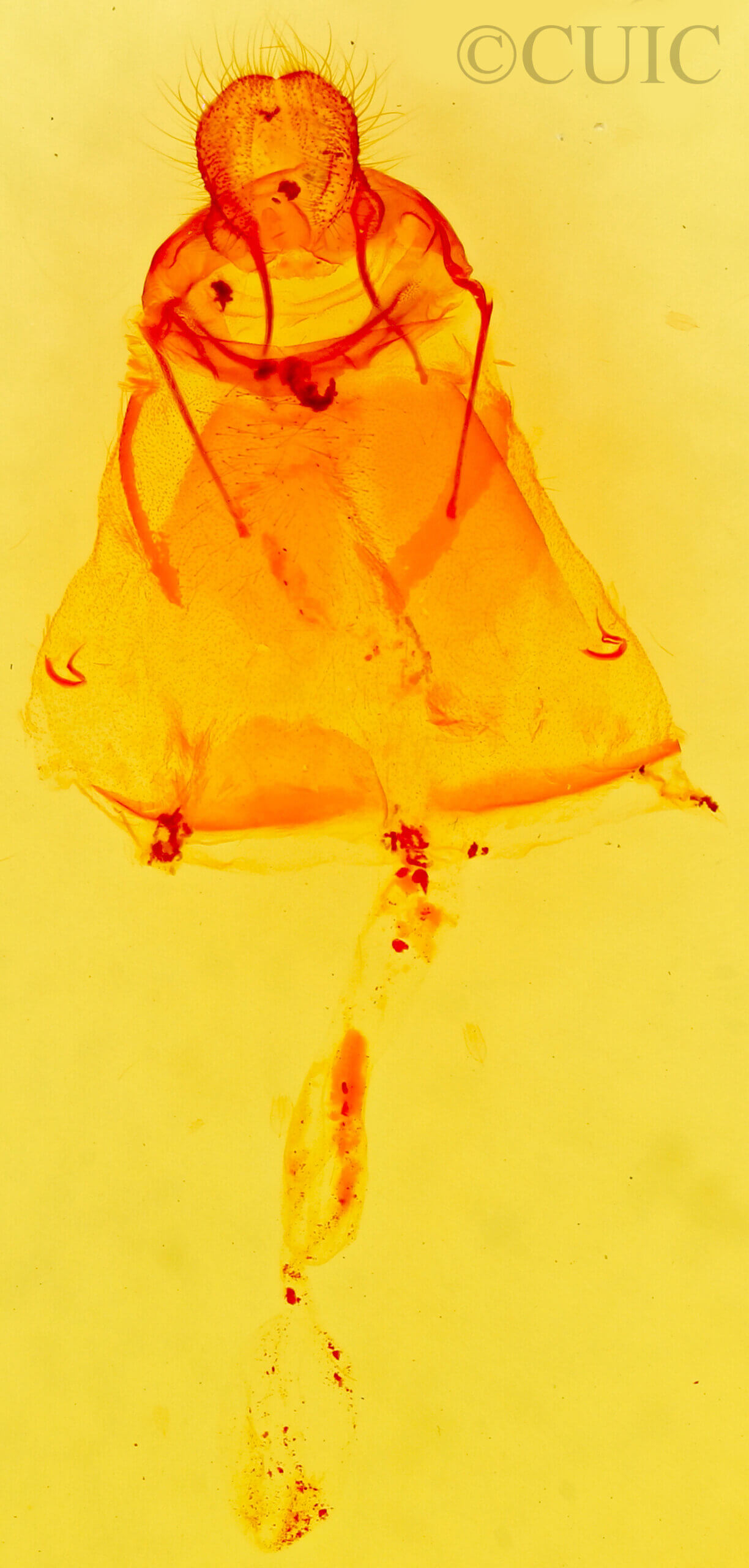 genitalia view of adult Lacosoma arizonicum