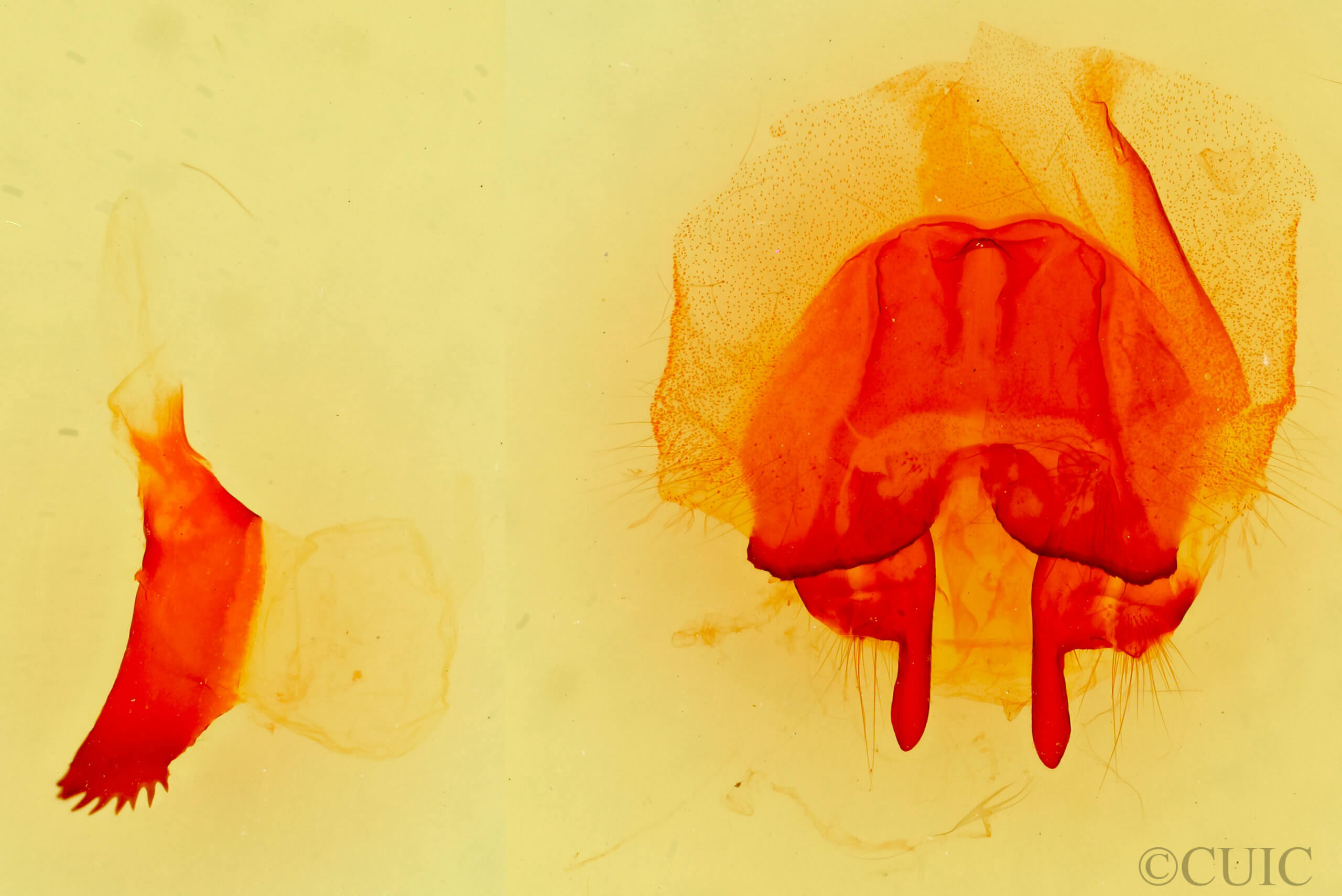 genitalia view of adult Gloveria medusa