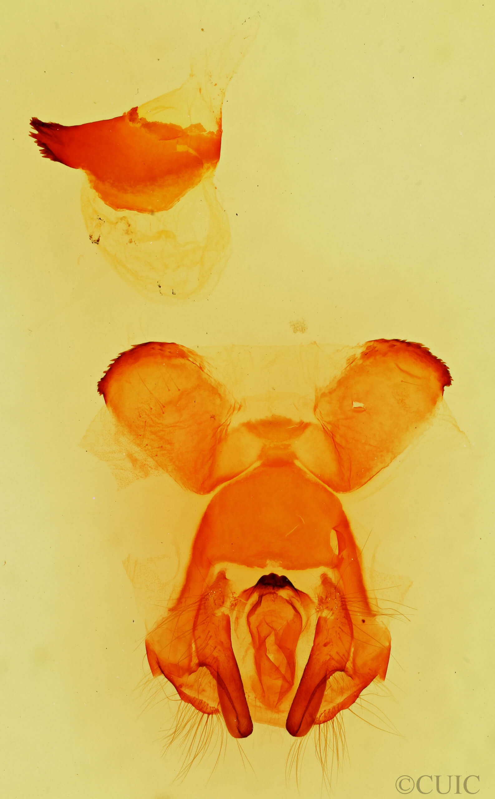 genitalia view of adult Quadrina diazoma