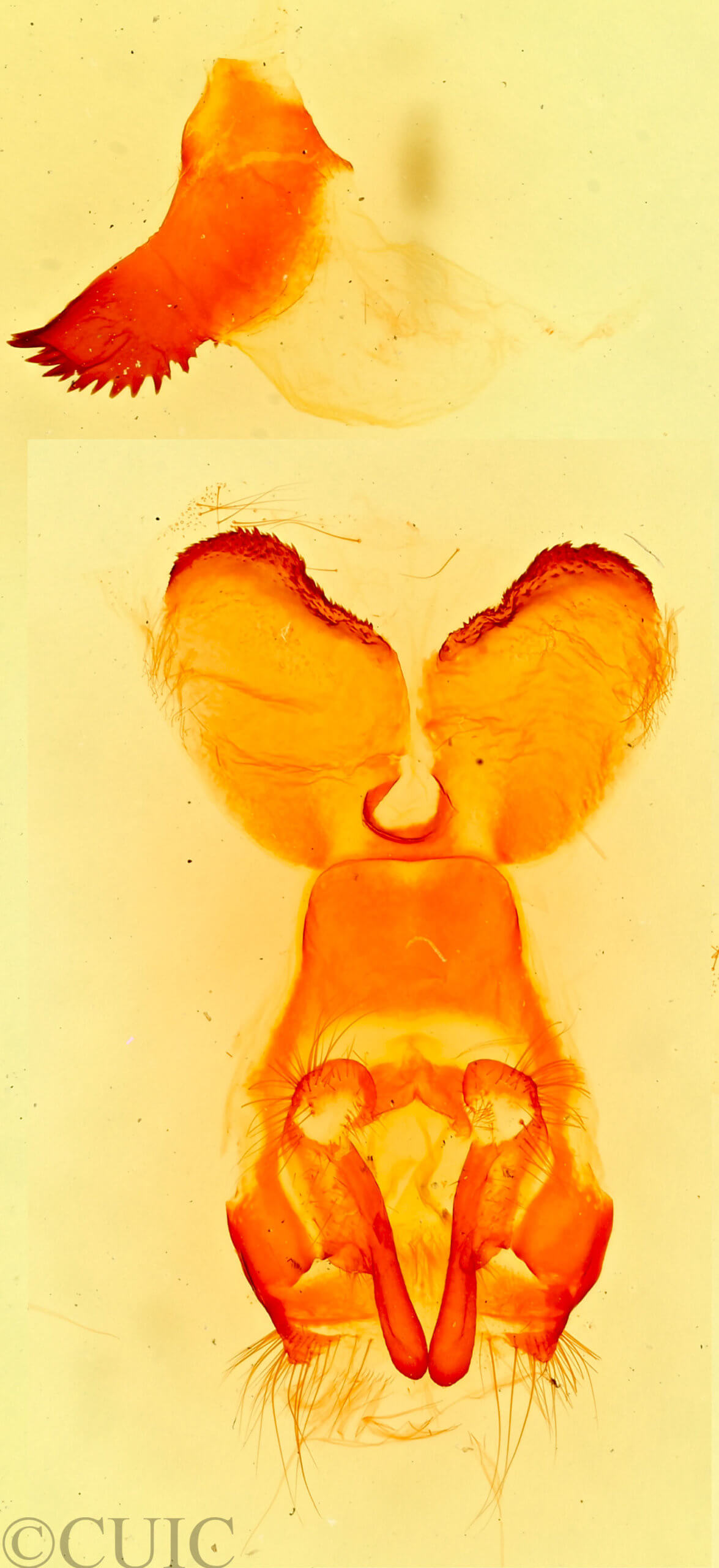 genitalia view of adult Gloveria gargamelle