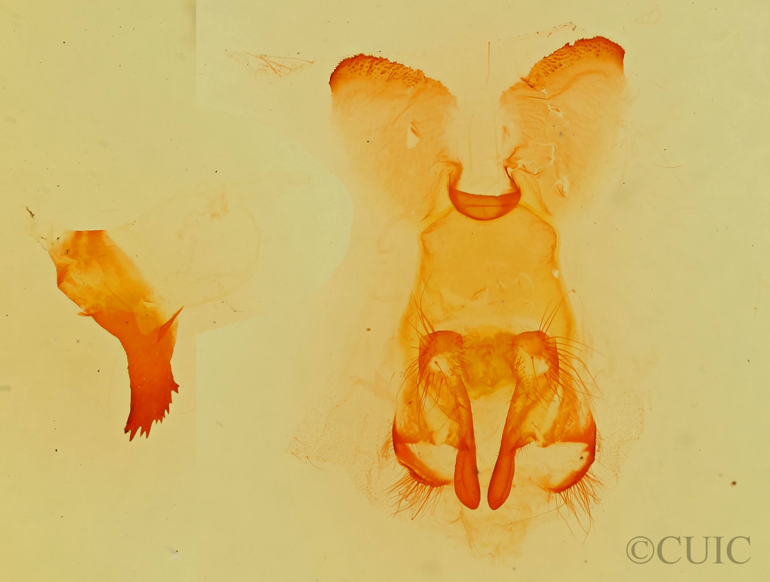 genitalia view of adult Gloveria medusa