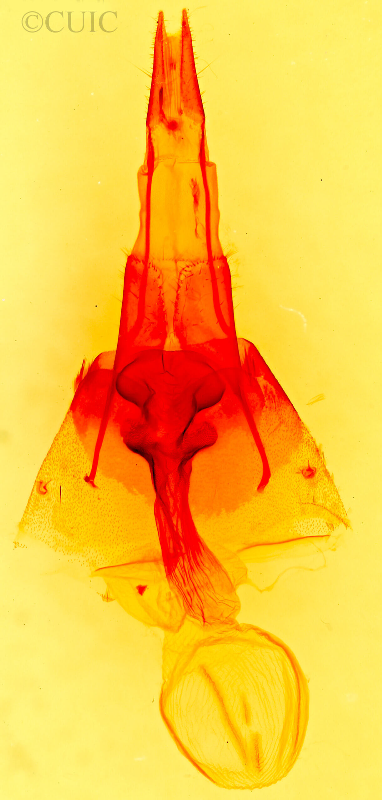 genitalia view of adult Hyperepia jugifera