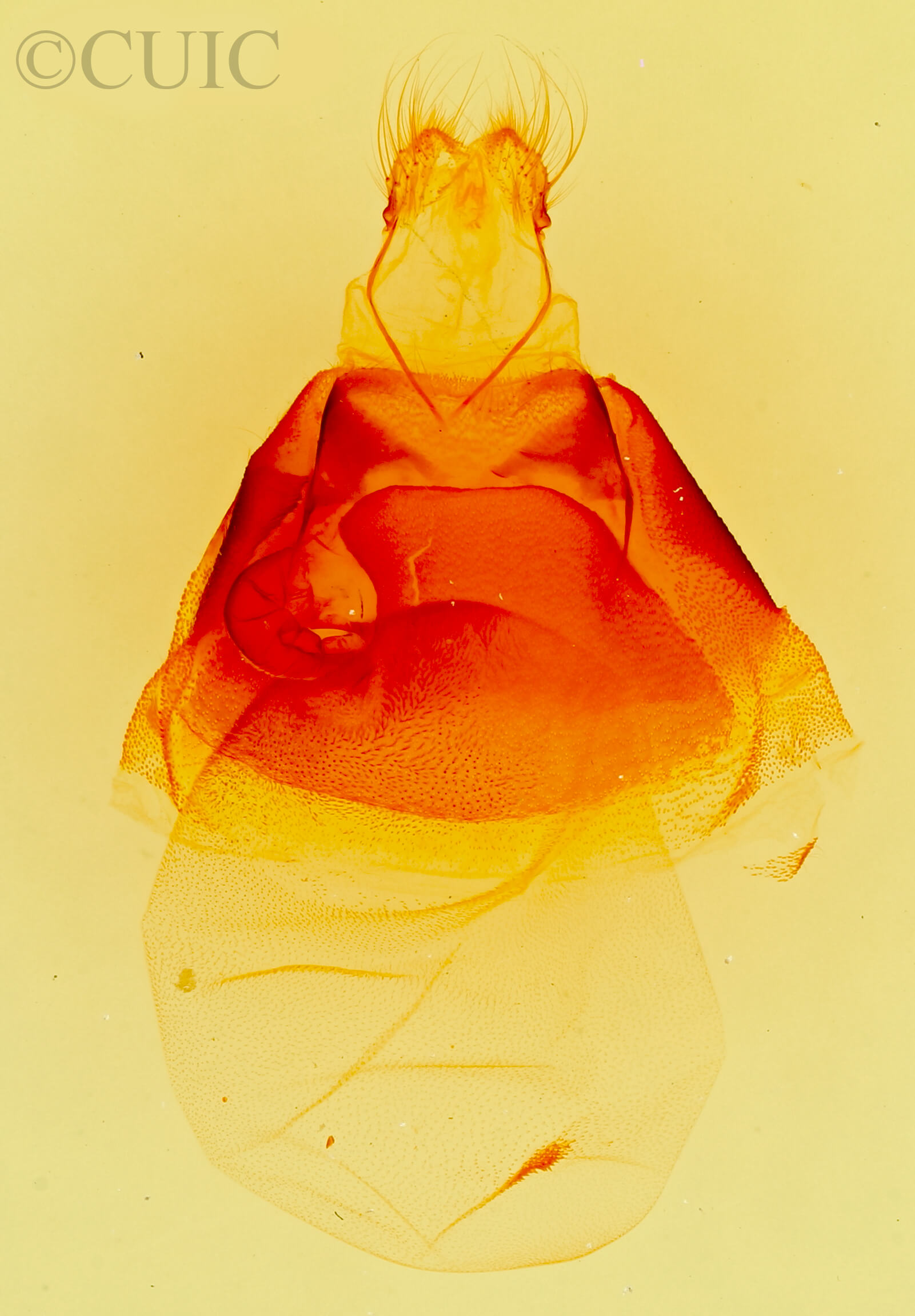 genitalia view of adult Matigramma rubrosuffusa