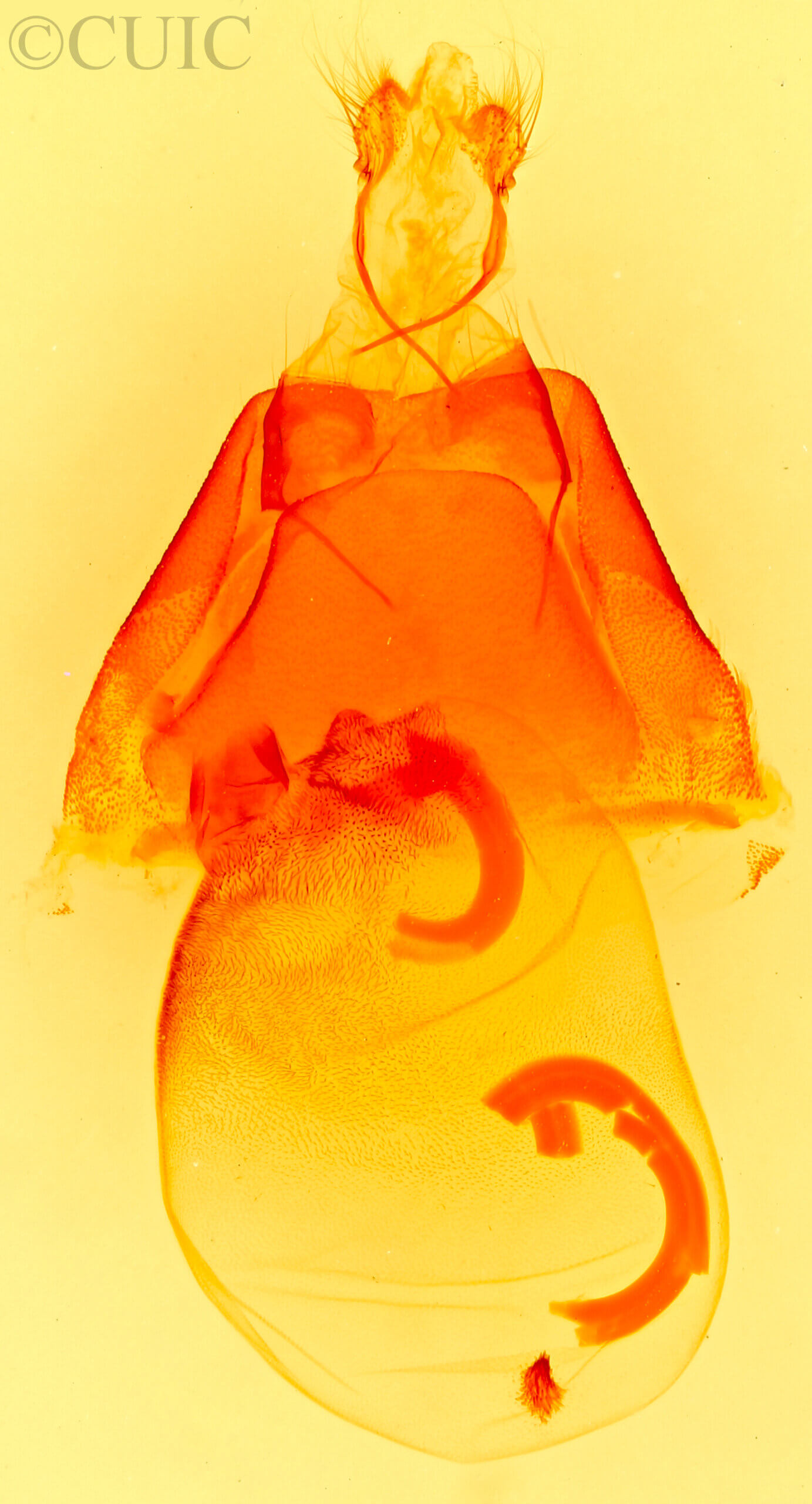 genitalia view of adult Matigramma emmilta