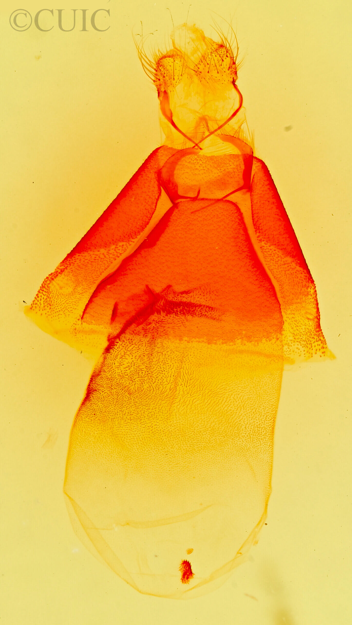 genitalia view of adult Matigramma emmilta