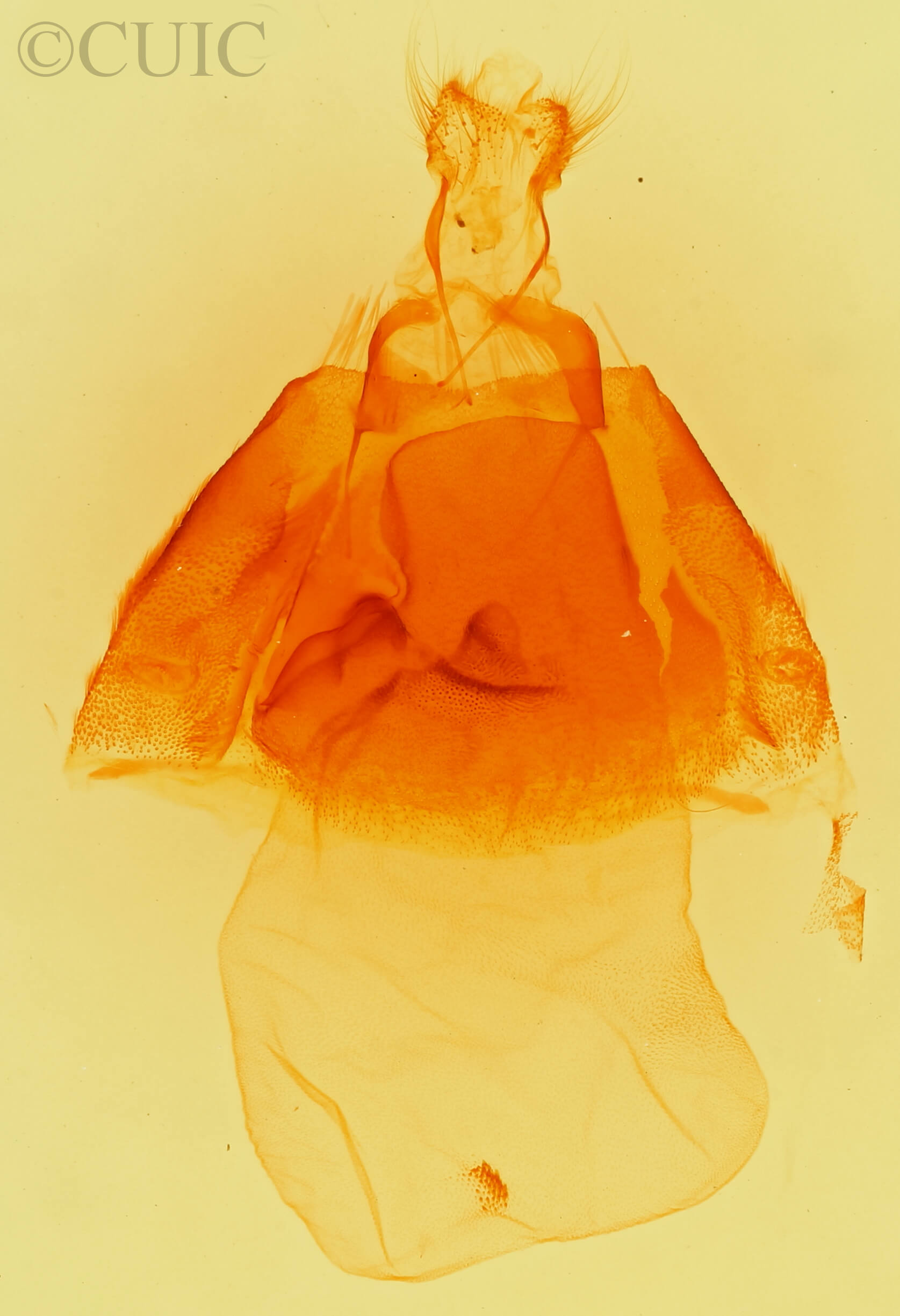 genitalia view of adult Matigramma inopinata