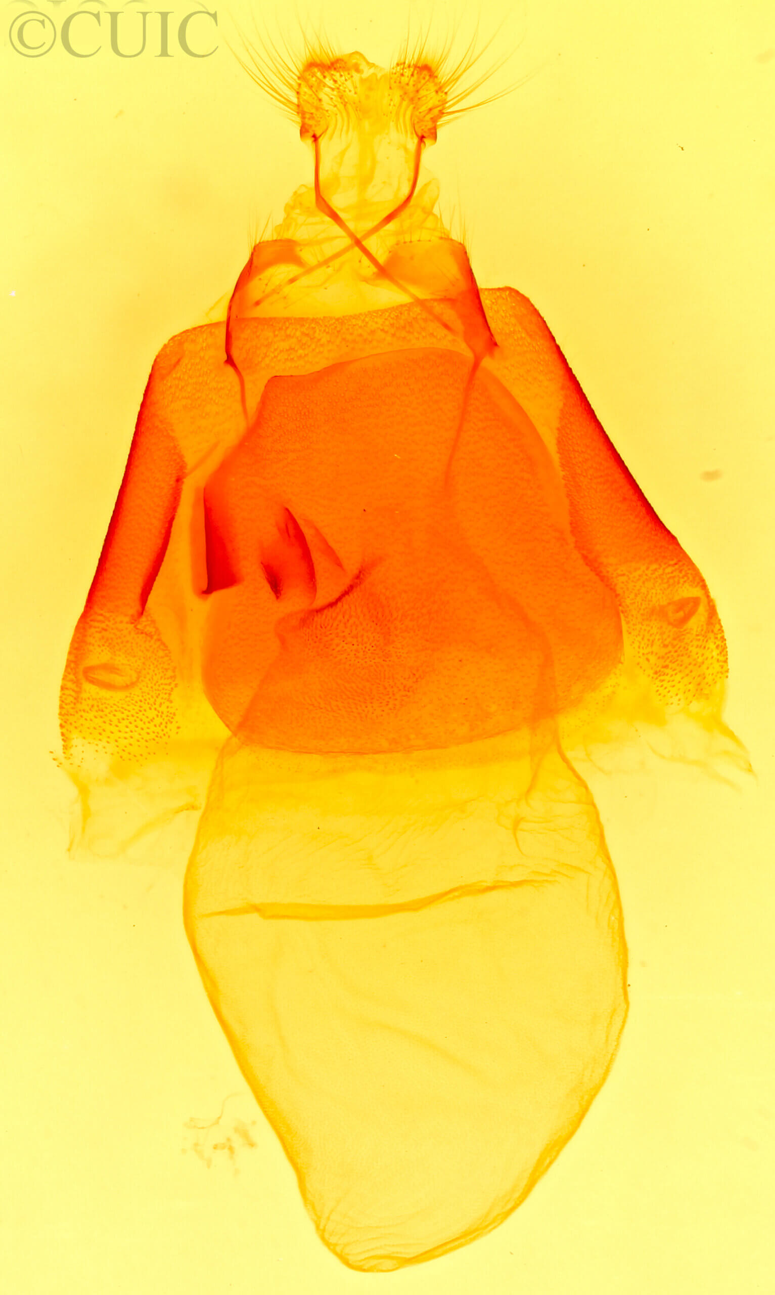 genitalia view of adult Matigramma  repentina