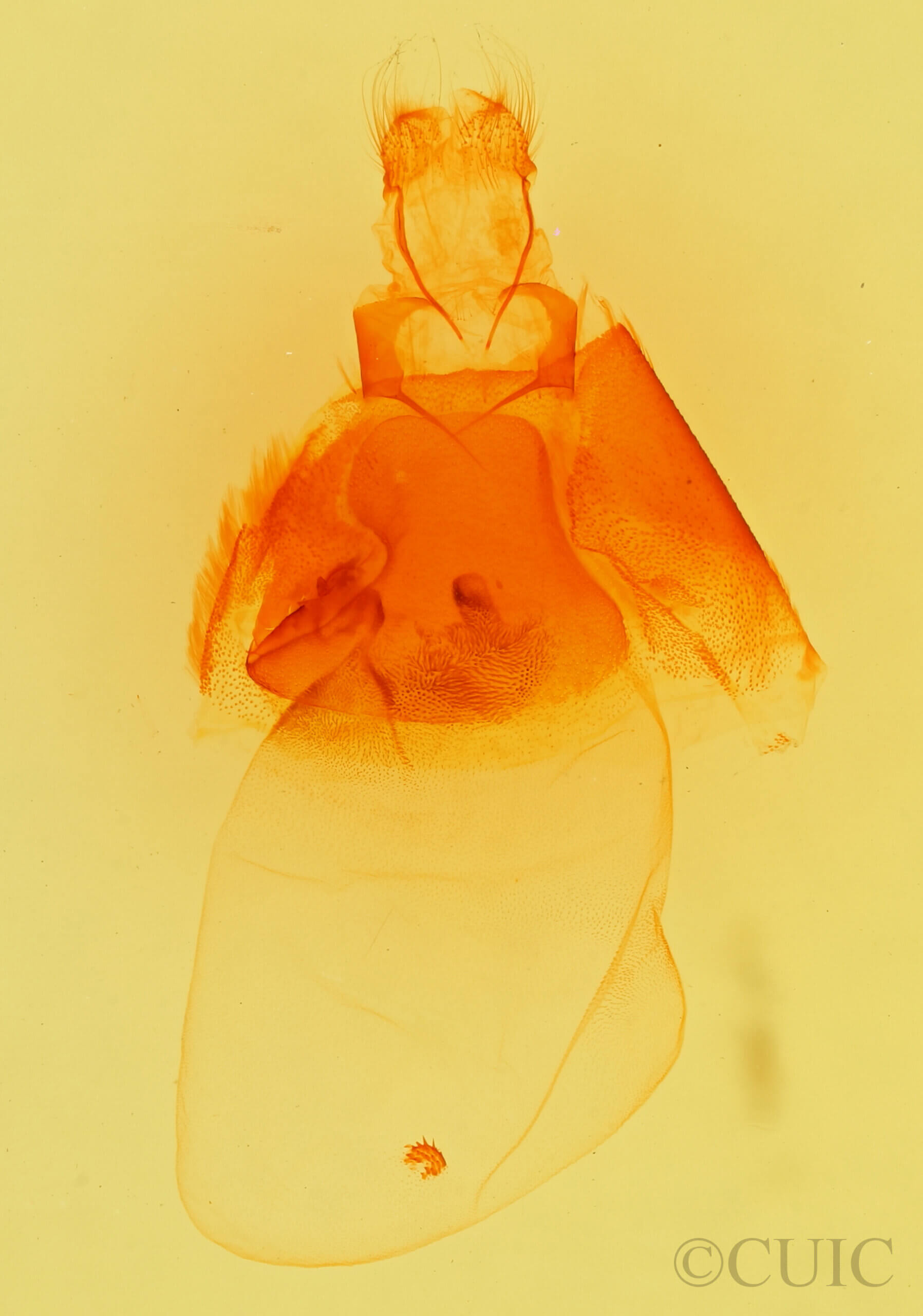 genitalia view of adult Matigramma inopinata