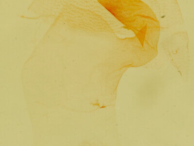 genitalia view of adult Lithacodia