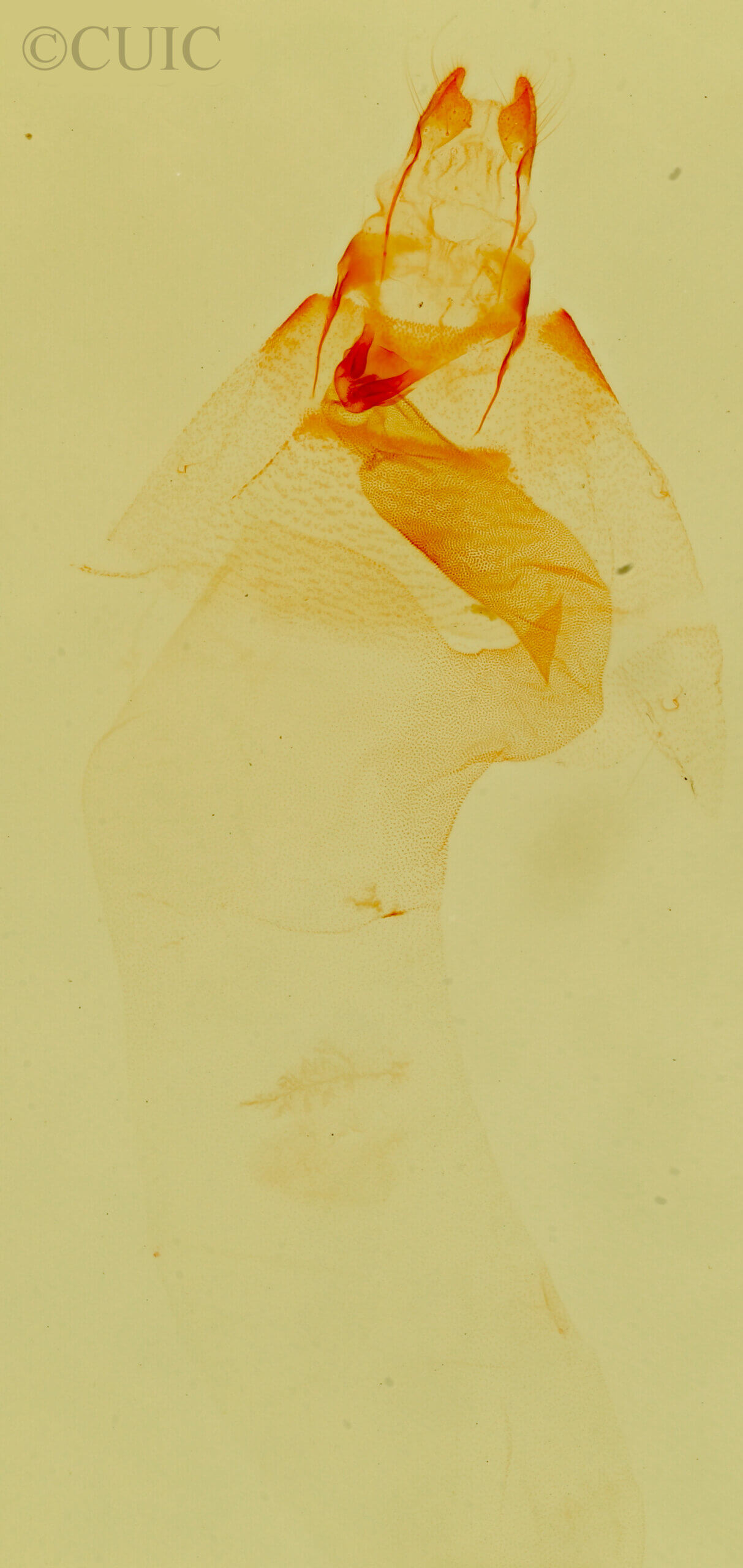 genitalia view of adult Lithacodia