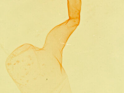 genitalia view of adult Lithacodia musta