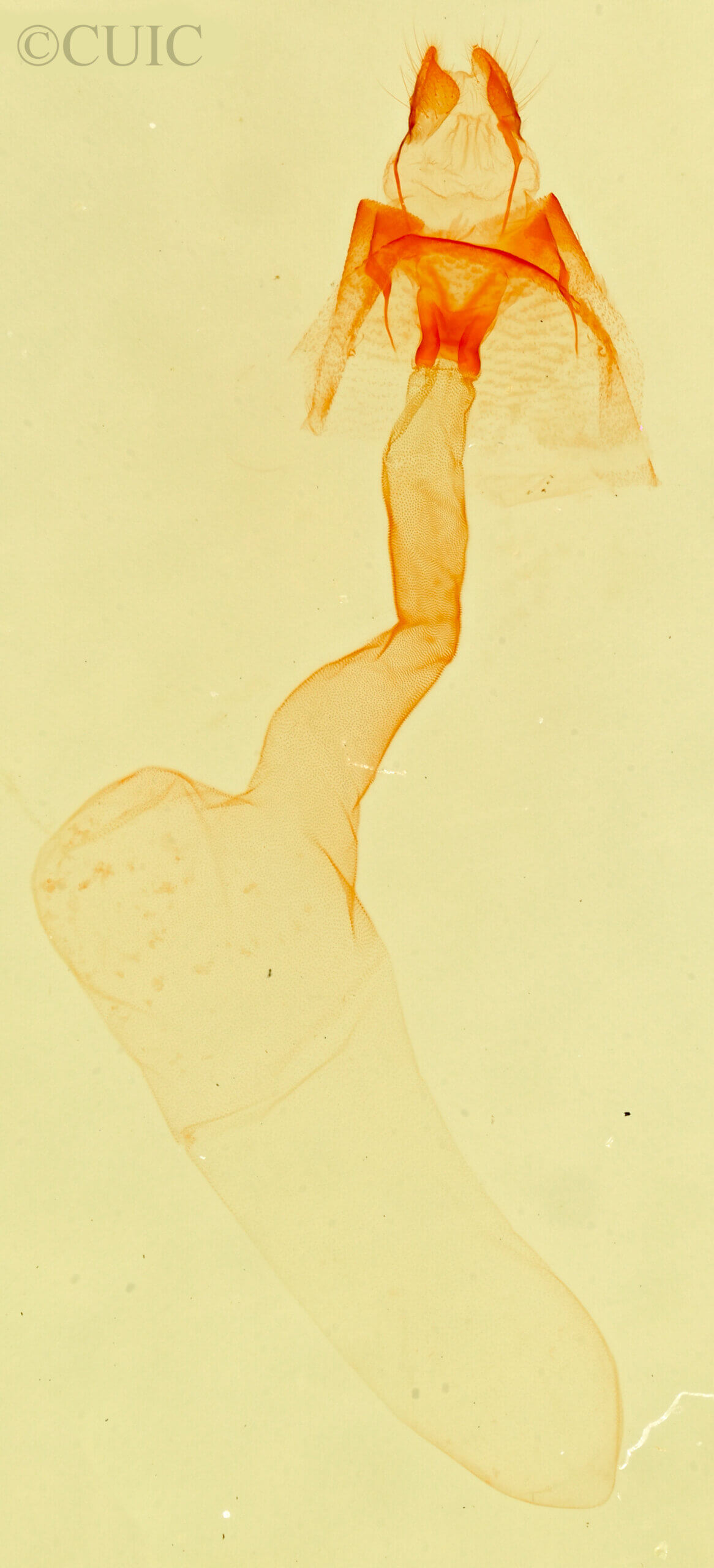 genitalia view of adult Lithacodia musta
