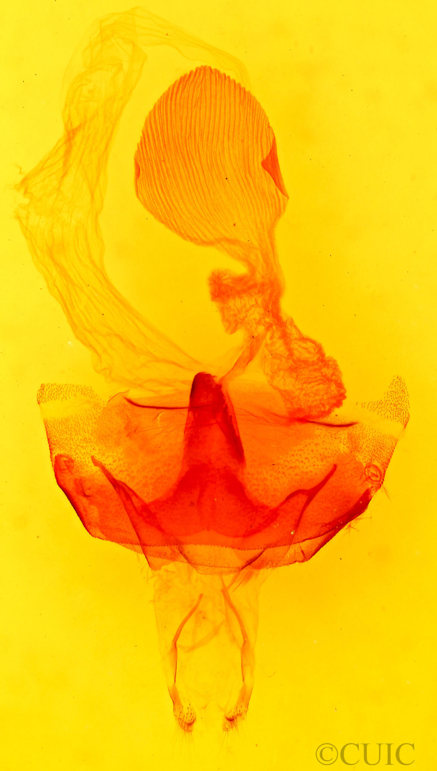 genitalia view of adult Abagrotis scopeops