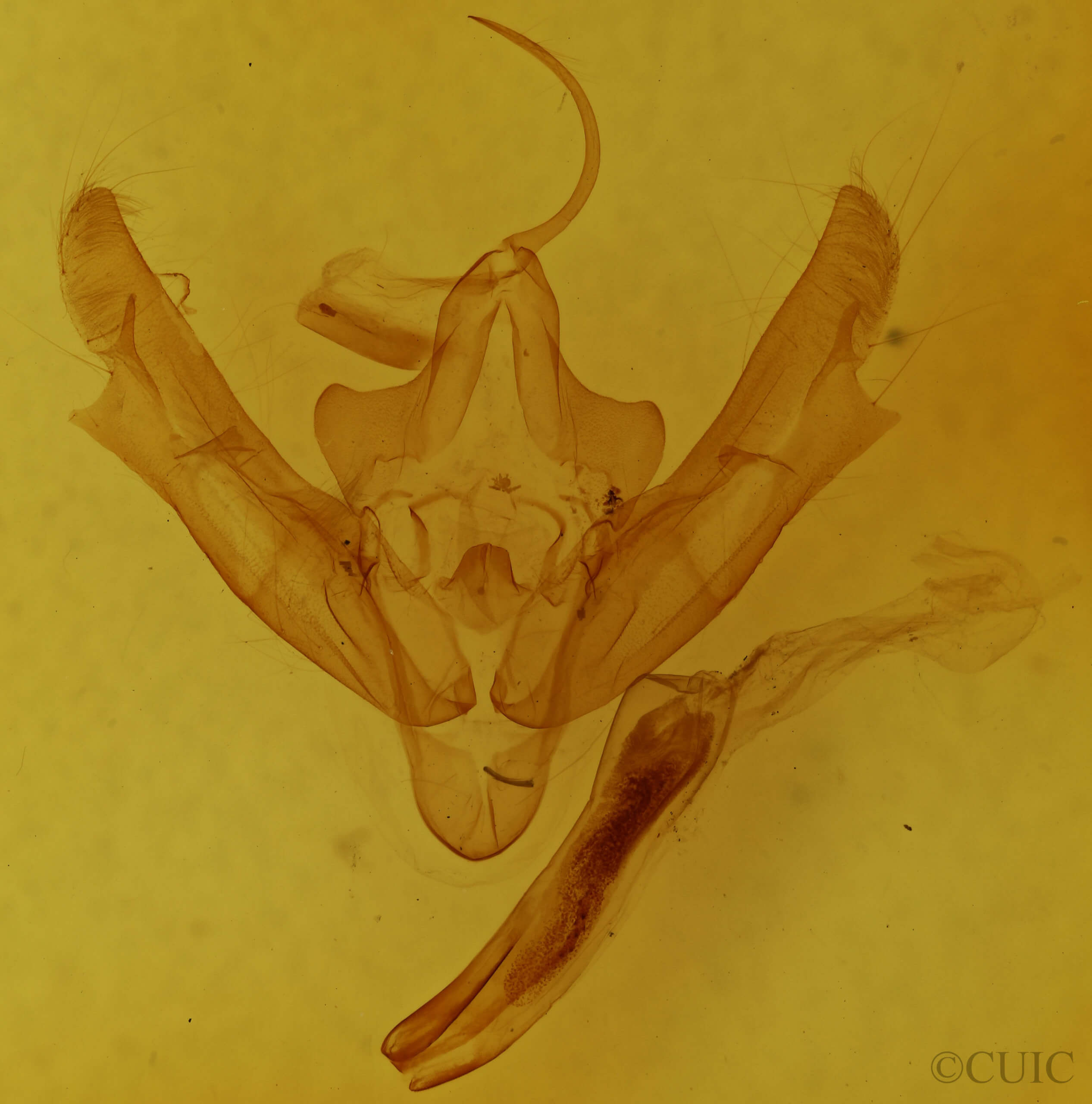 genitalia view of adult Xestia efflorescens
