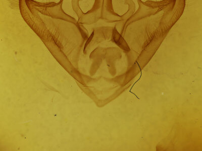 genitalia view of adult Halysidota
