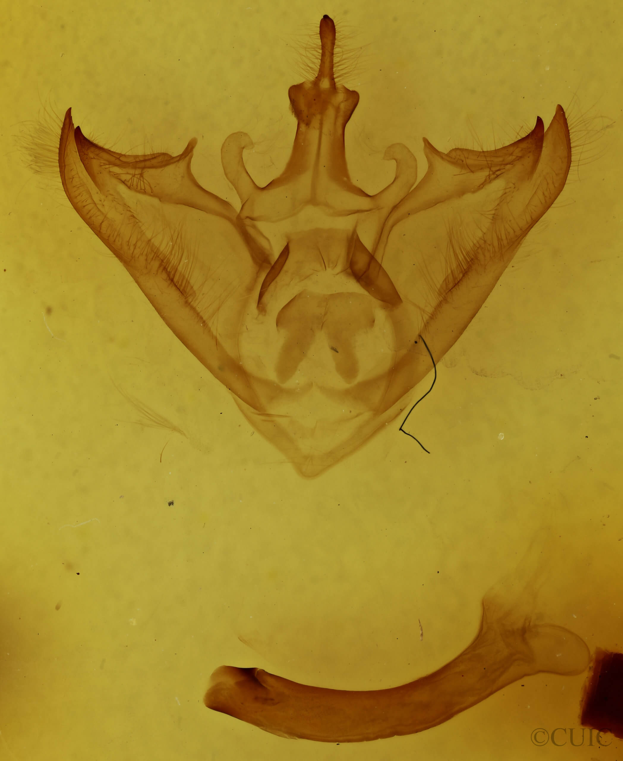 genitalia view of adult Halysidota