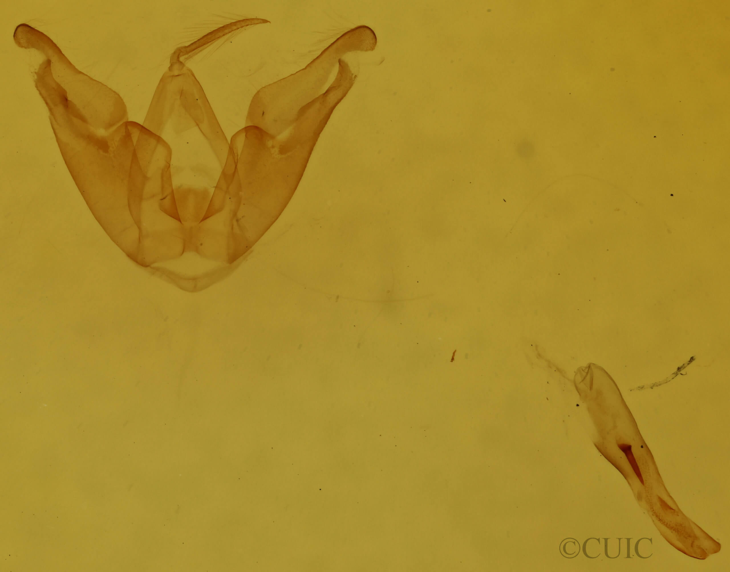 genitalia view of adult Hyperstrotia