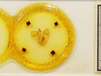 slide view of adult Pentobesa