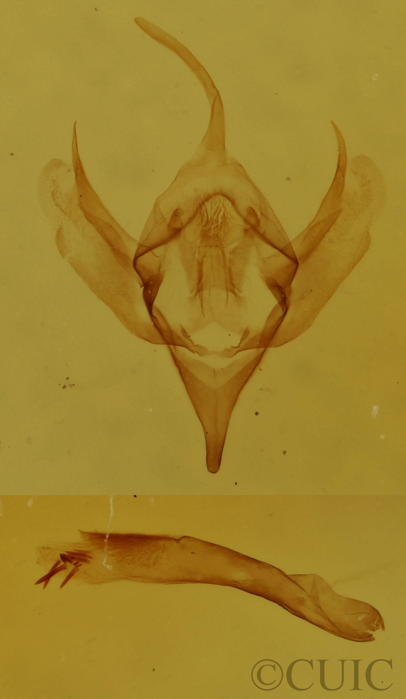 genitalia view of adult Xanthorhoe
