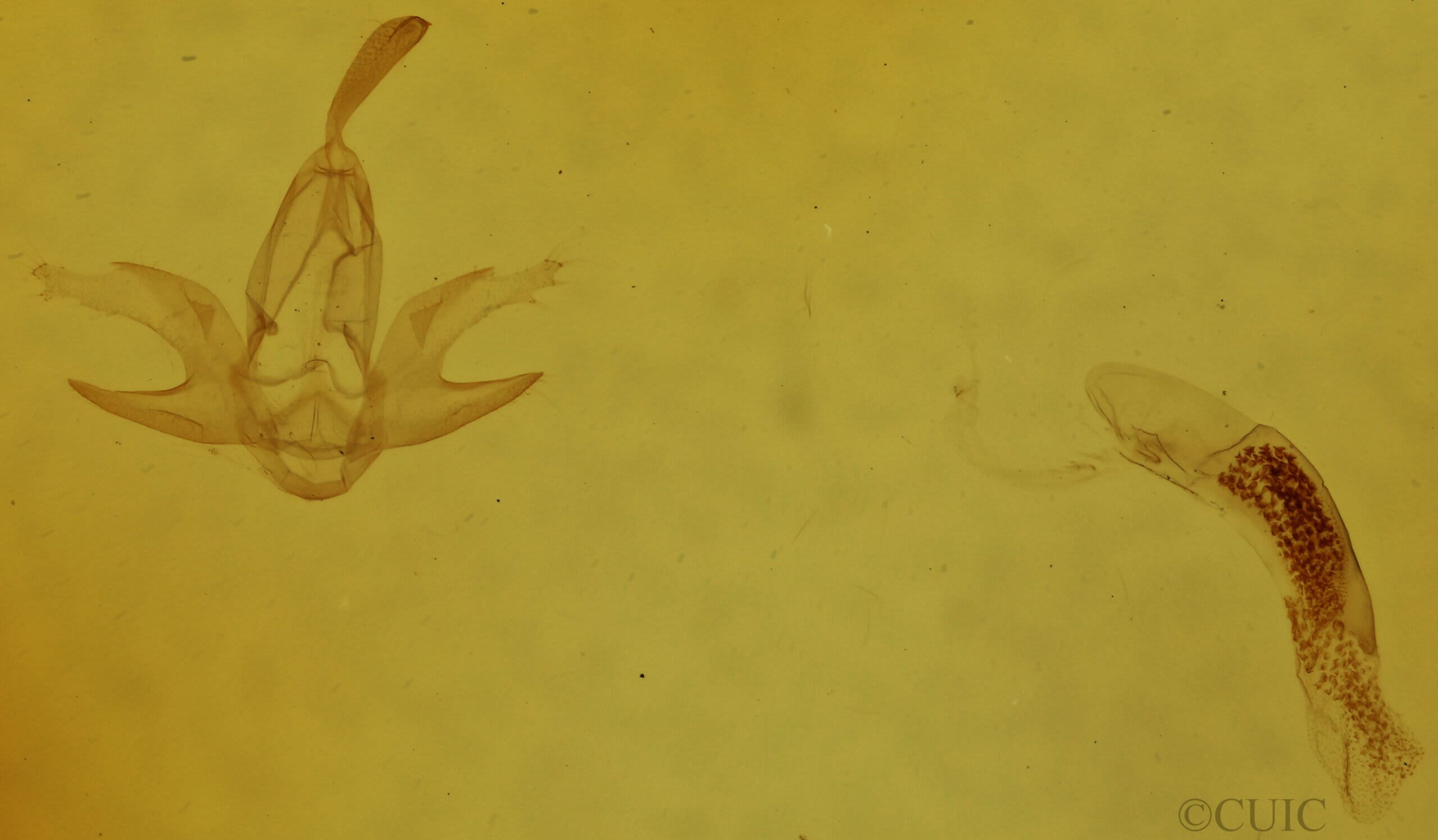 genitalia view of adult Zanclognatha protumnusalis/dentata