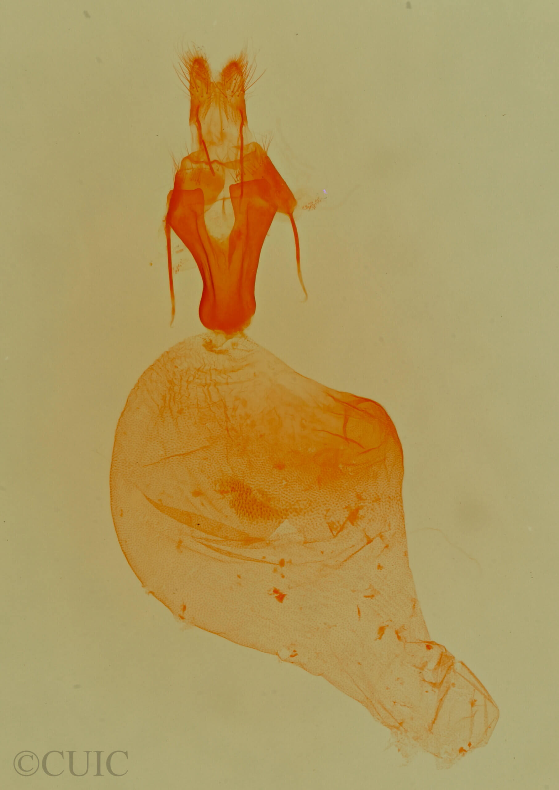 genitalia view of adult Pseudeustrotia  carneola 