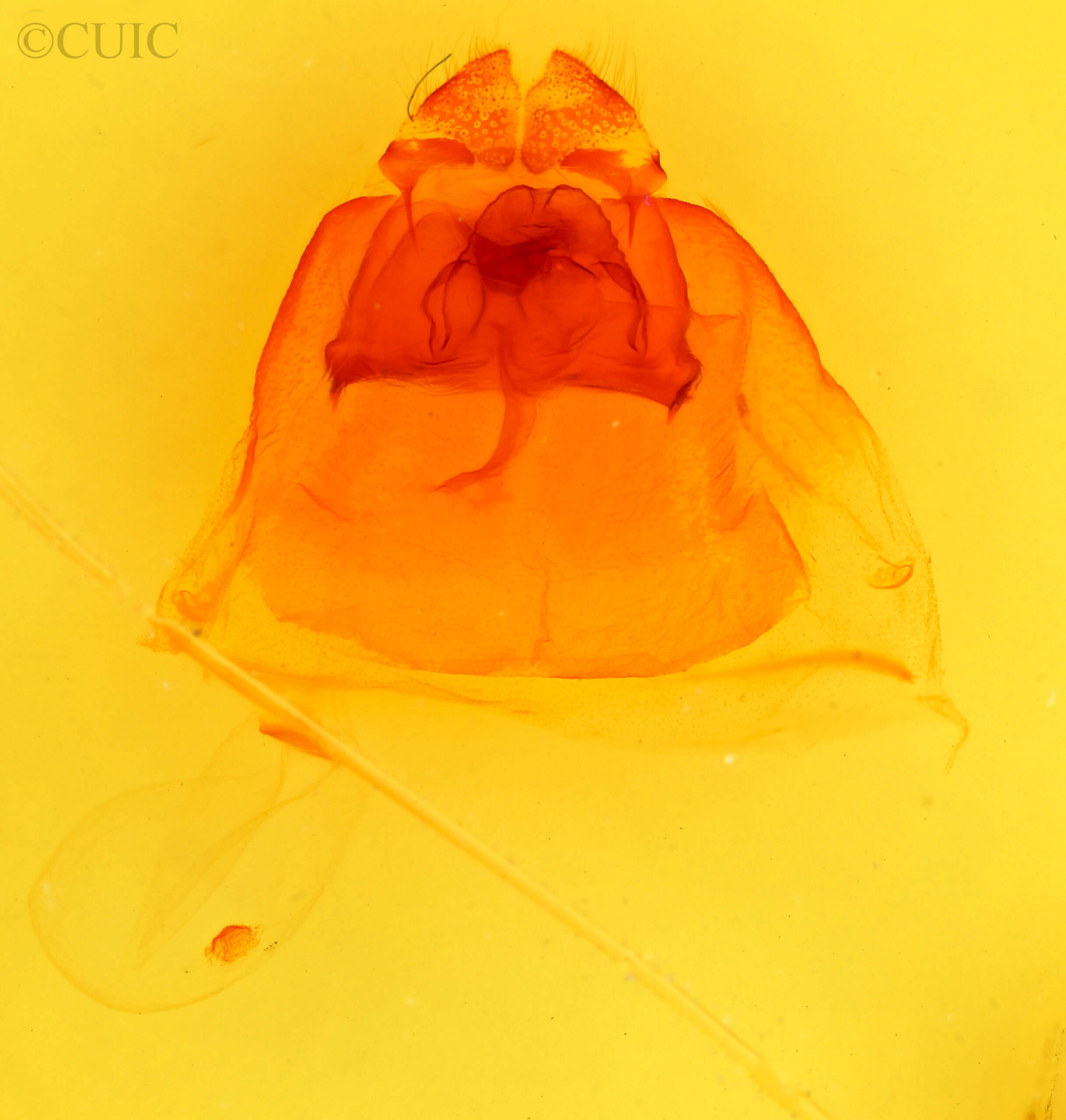 genitalia view of adult Ianassa pallida