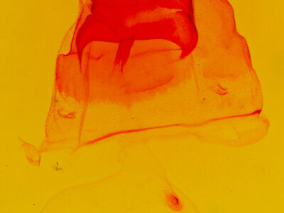 genitalia view of adult Coelodasys unicornis