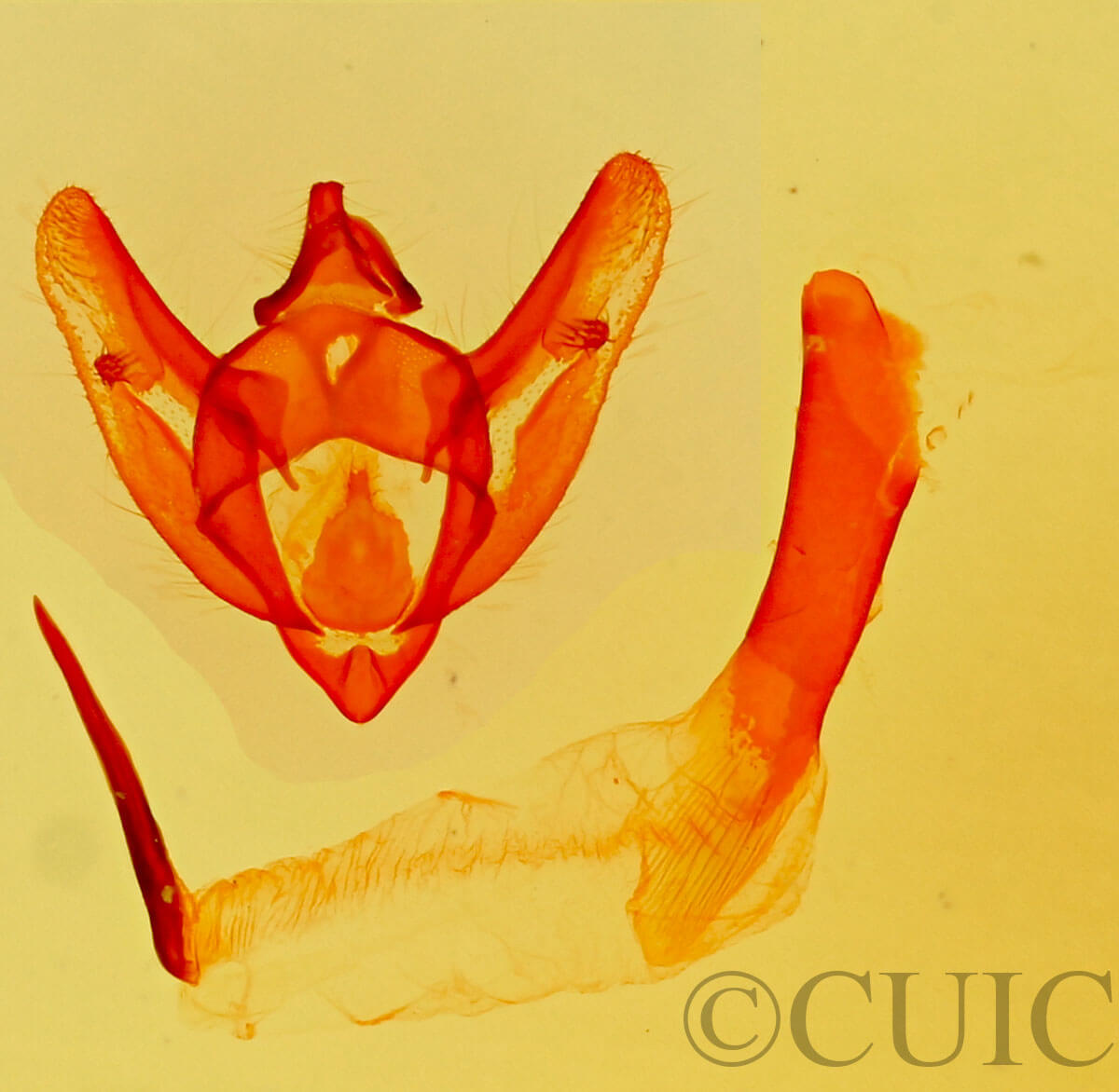 genitalia view of adult Phigalia strigataria