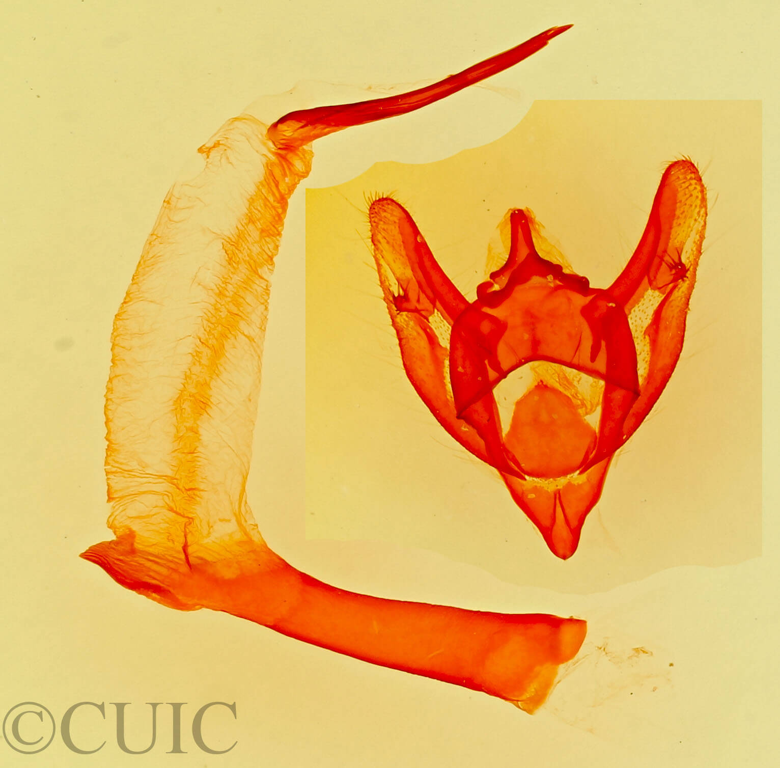 genitalia view of adult Phigalia strigataria