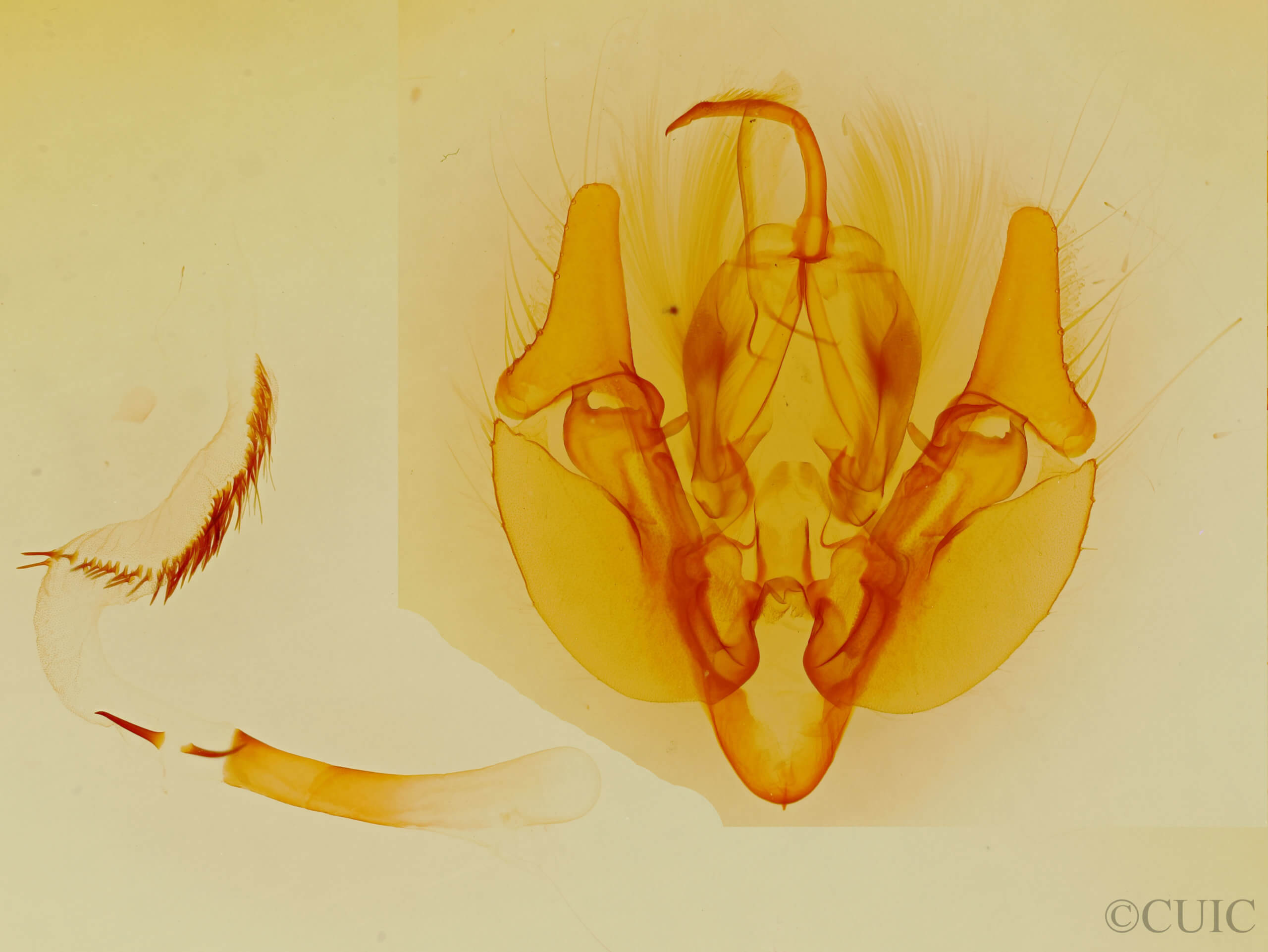 genitalia view of adult Leucania  latiuscula (incognita) 