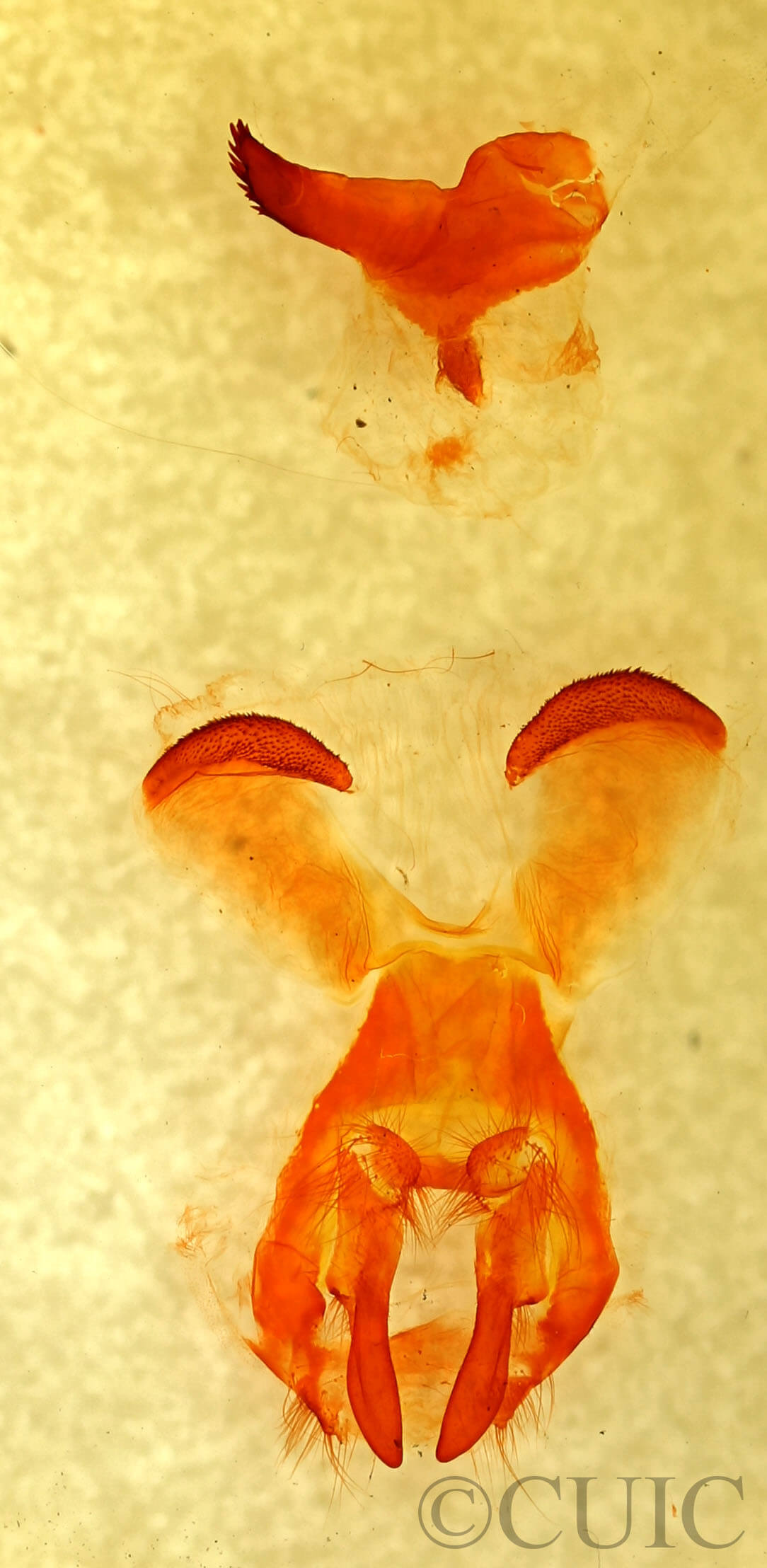 slide view of adult Lebeda 