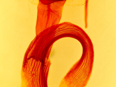 genitalia view of adult Leucania  adjuta