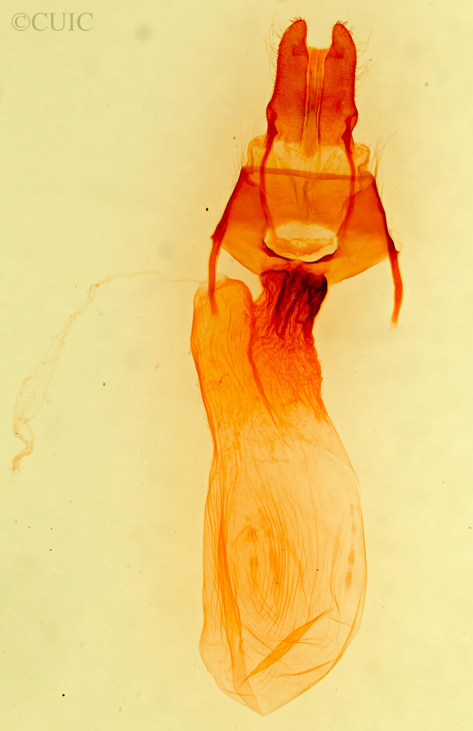 genitalia view of adult Apamea zeta murrayi