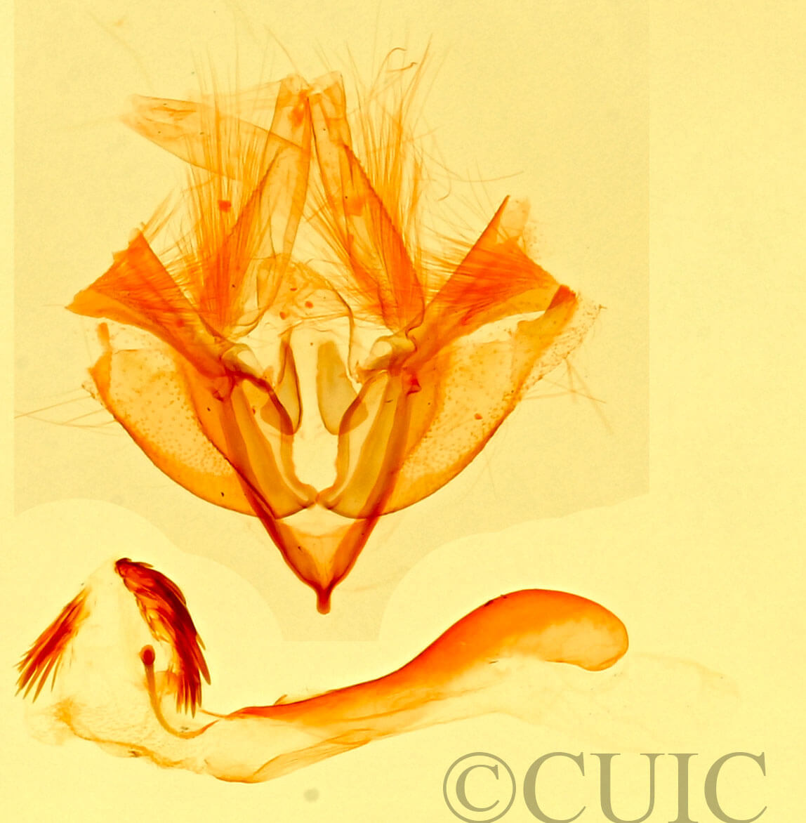 genitalia view of adult Pseudeustrotia indeterminata