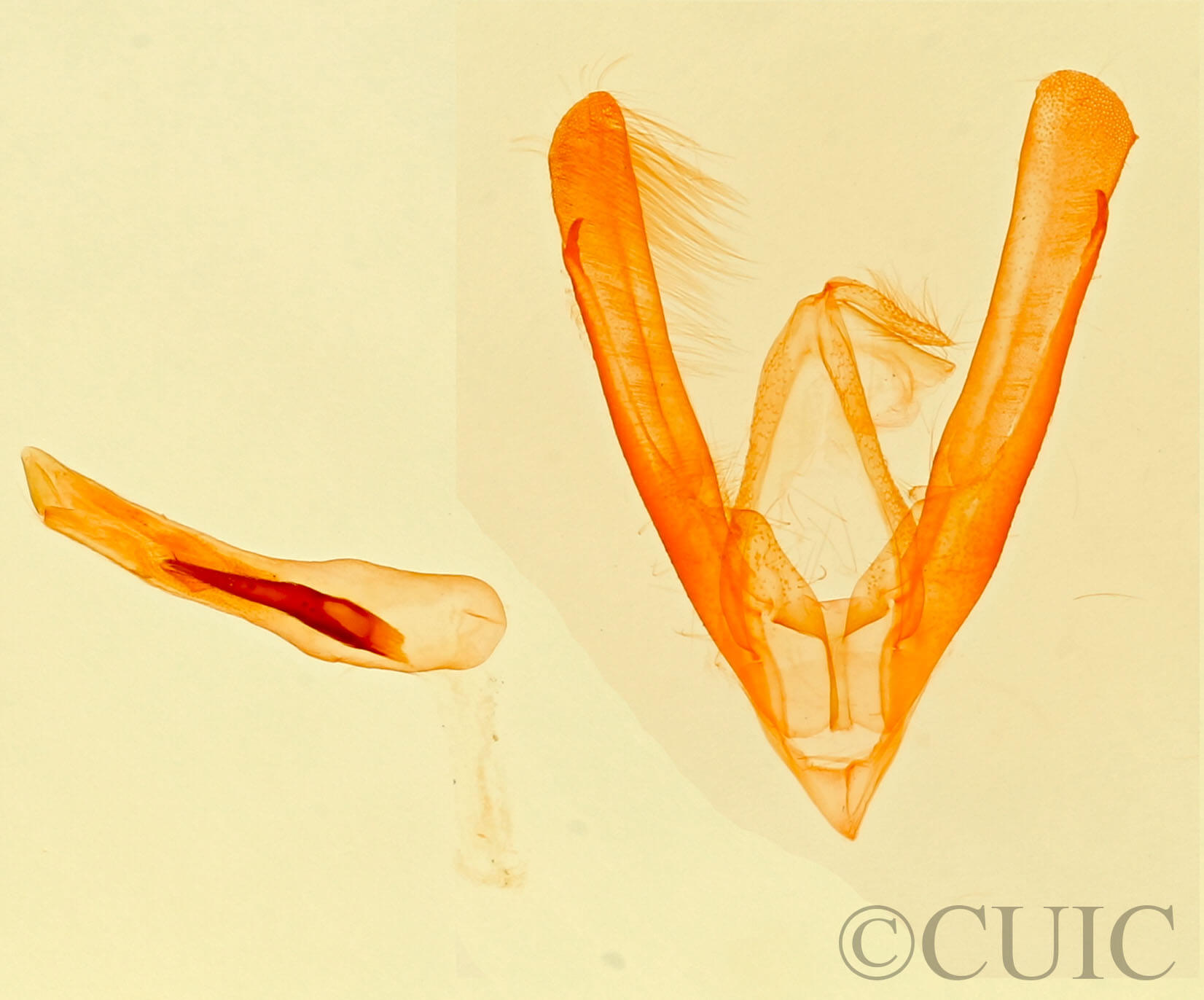 genitalia view of adult Neustrotia  sugii