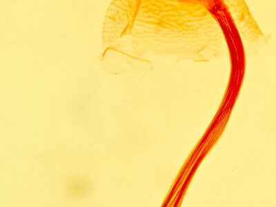 genitalia view of adult Bleptina inferior