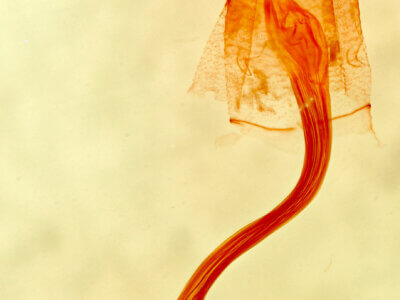 genitalia view of adult Bleptina inferior