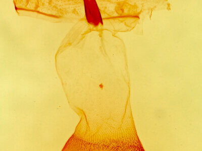 genitalia view of adult Renia discoloralis