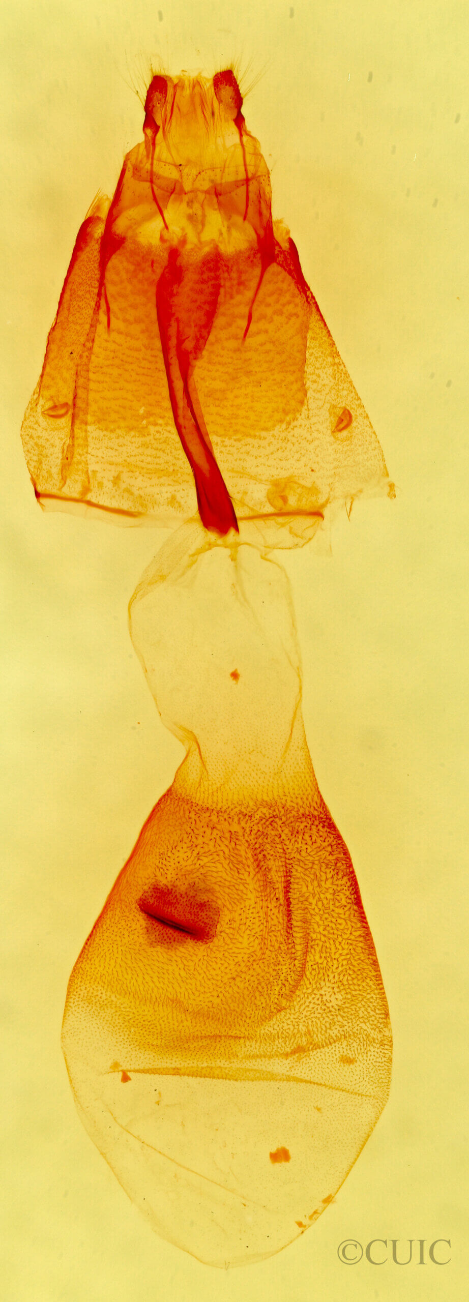 genitalia view of adult Renia discoloralis