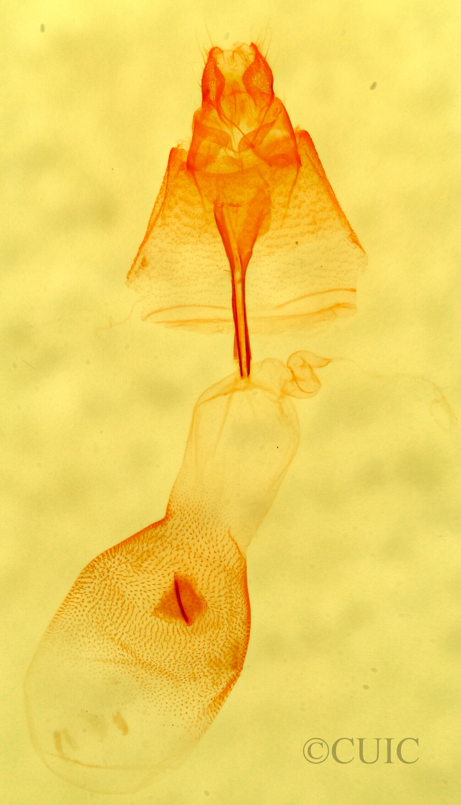 genitalia view of adult Renia factiosalis