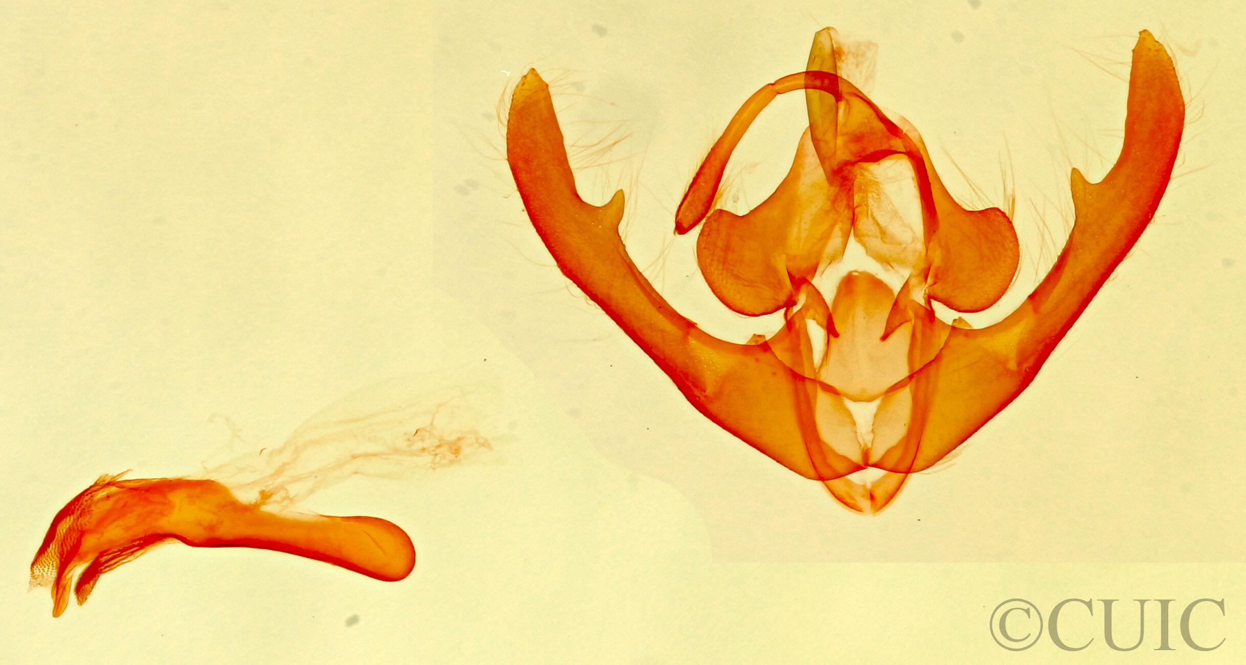 genitalia view of adult Deltote bellicula