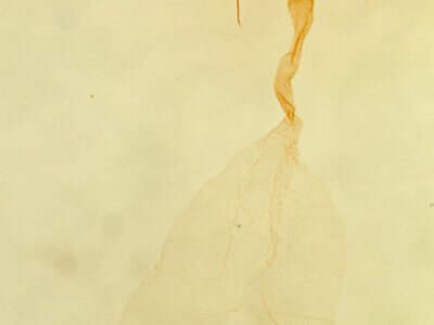 genitalia view of adult Deltote bellicula