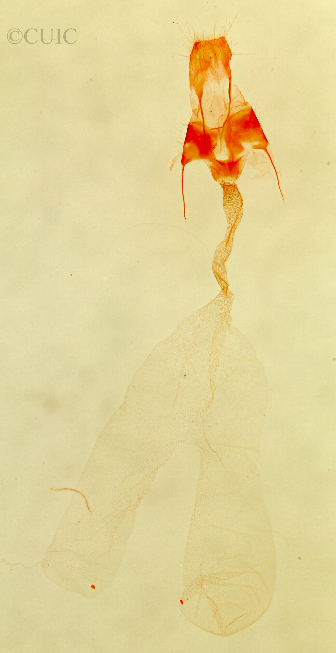 genitalia view of adult Deltote bellicula