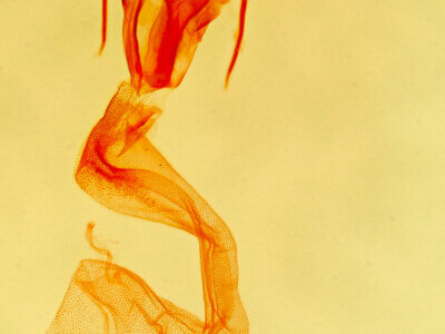 genitalia view of adult Protodeltote muscosula